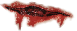 Scar PNG-15755